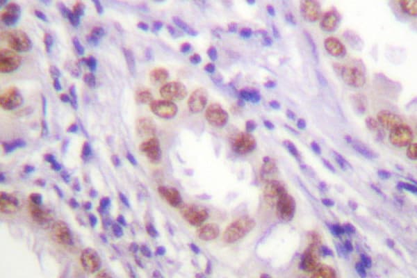 Histone H3 Antibody (Lys9)