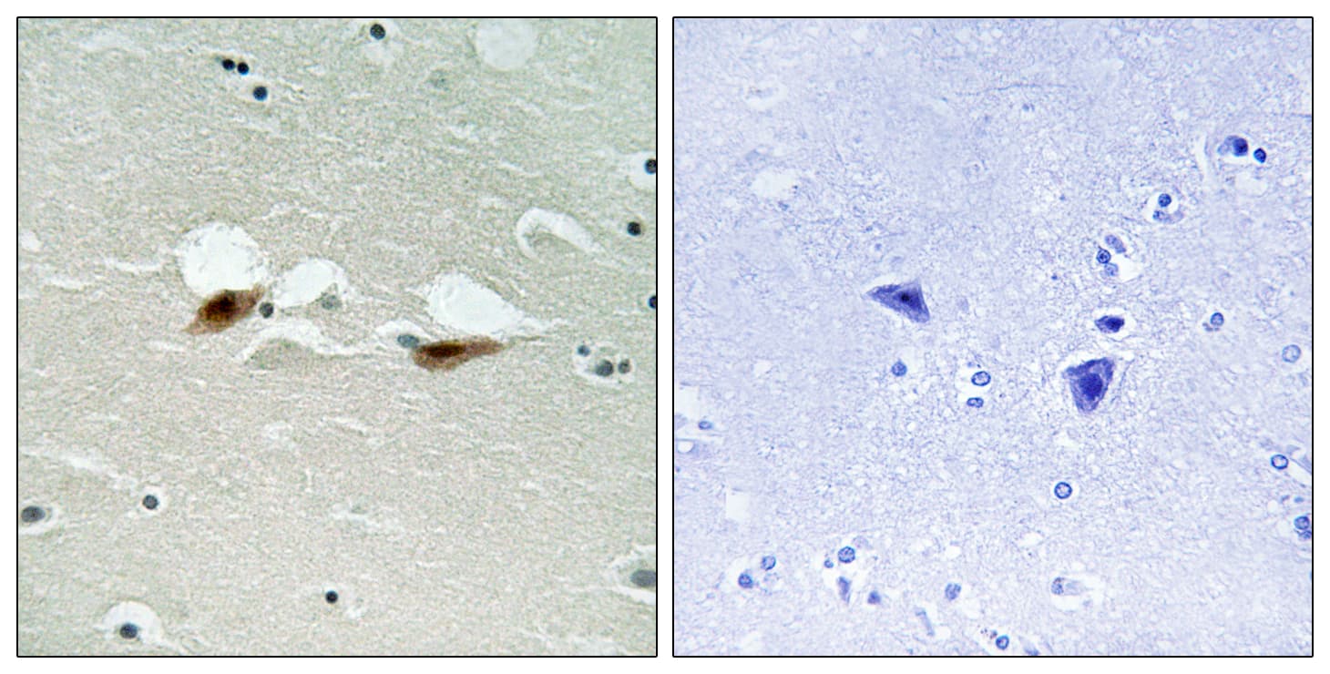 ATF2 Antibody (phospho-Ser472)