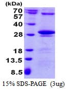 Human TK2 Protein (Recombinant His)