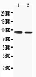 SLC9A2 / NHE2 Antibody (aa666-684)