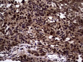 Monoclonal Mouse anti-Human NBN / Nibrin Antibody (clone OTI8E7, IHC, WB)