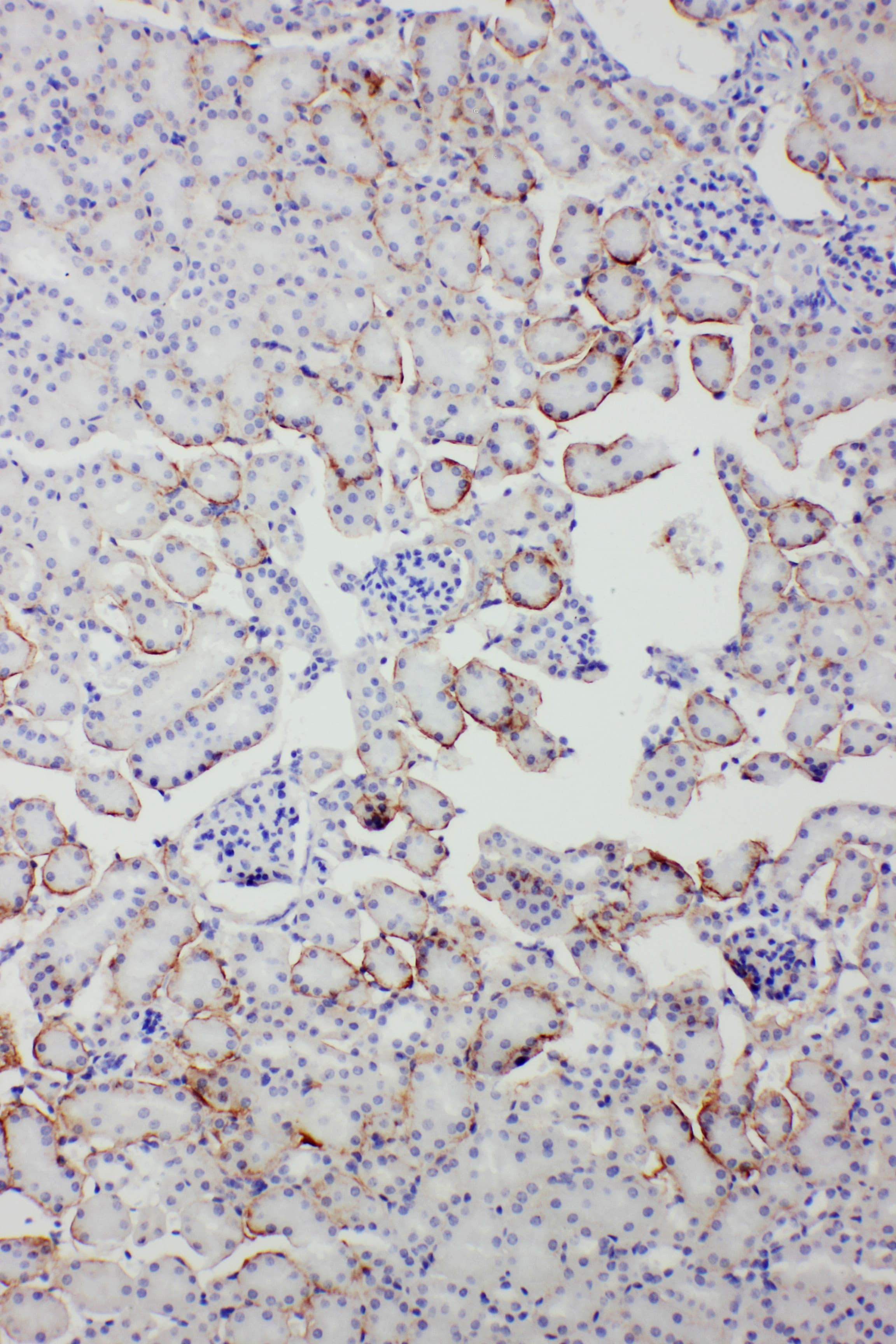 APCS / Serum Amyloid P / SAP Antibody (aa21-224)