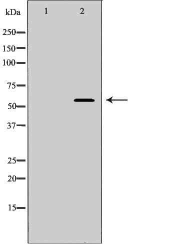 SPAM1 / PH20 Antibody (aa216-244)