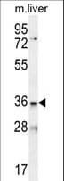 LDLRAD3 Antibody (aa317-345)