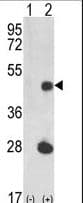 Luc7 / LUC7L Antibody (aa308-336)