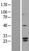 SNRPB2 Protein (Over-Expression Lysate Myc-DDK (Flag))