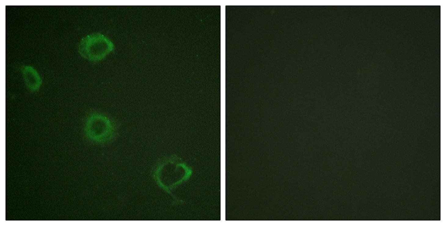 CD119 / IFNGR1 Antibody (phospho-Tyr457)