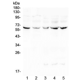 Lumican Antibody