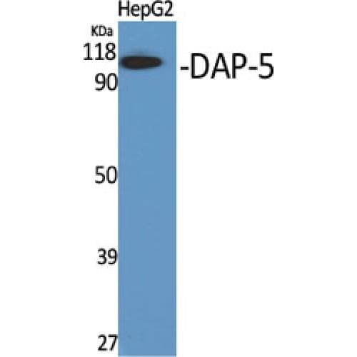 Polyclonal Rabbit anti-Human DAP-5 / EIF4G2 Antibody (10-90 aa, N-terminal, IHC, IF, WB)