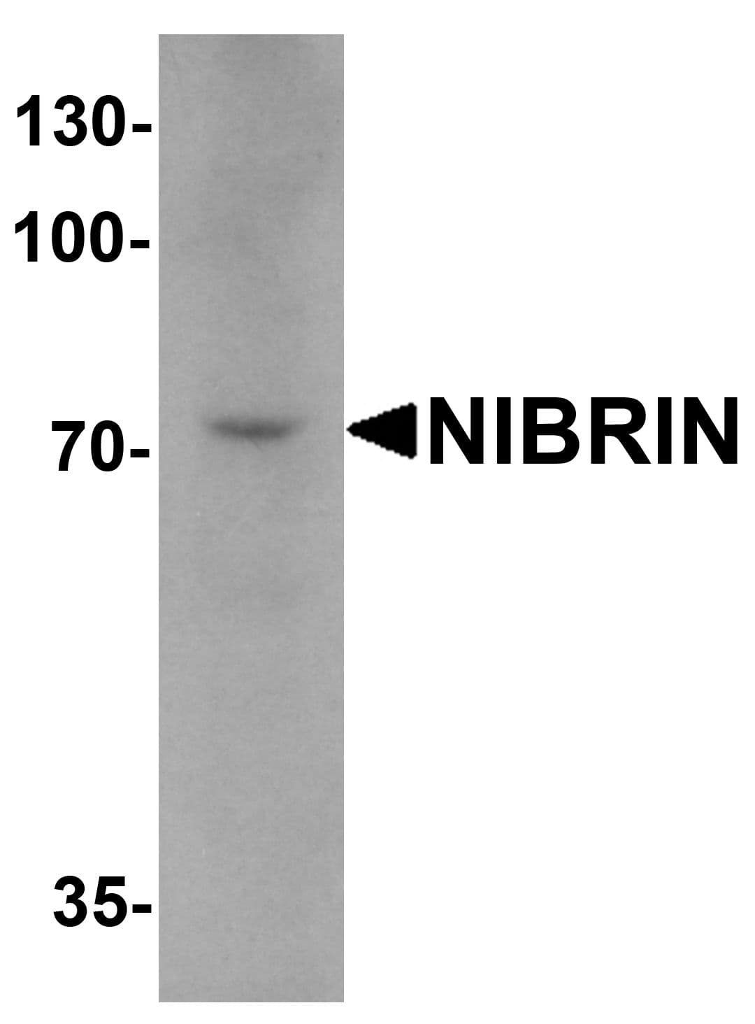 NBN / Nibrin Antibody