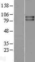VRL1 / TRPV2 Protein (Over-Expression Lysate Myc-DDK (Flag))