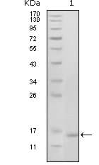 EPHB6 / EPH Receptor B6 Antibody (clone 2A6B9)