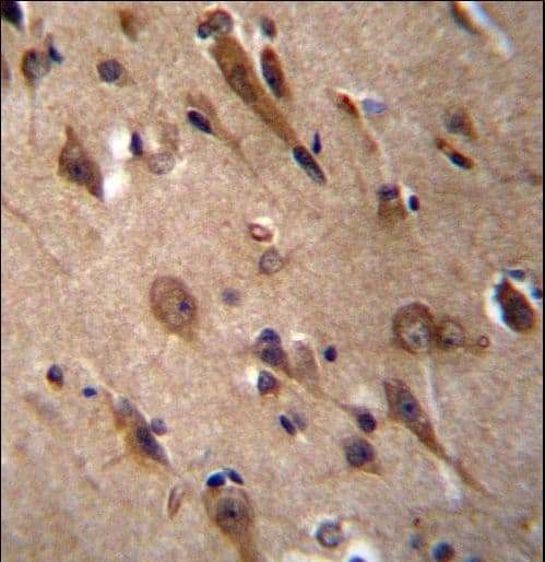RIC3 Antibody (aa313-341)