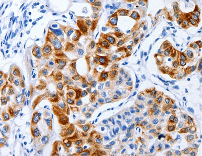 BPIFB3 / C20orf185 Antibody
