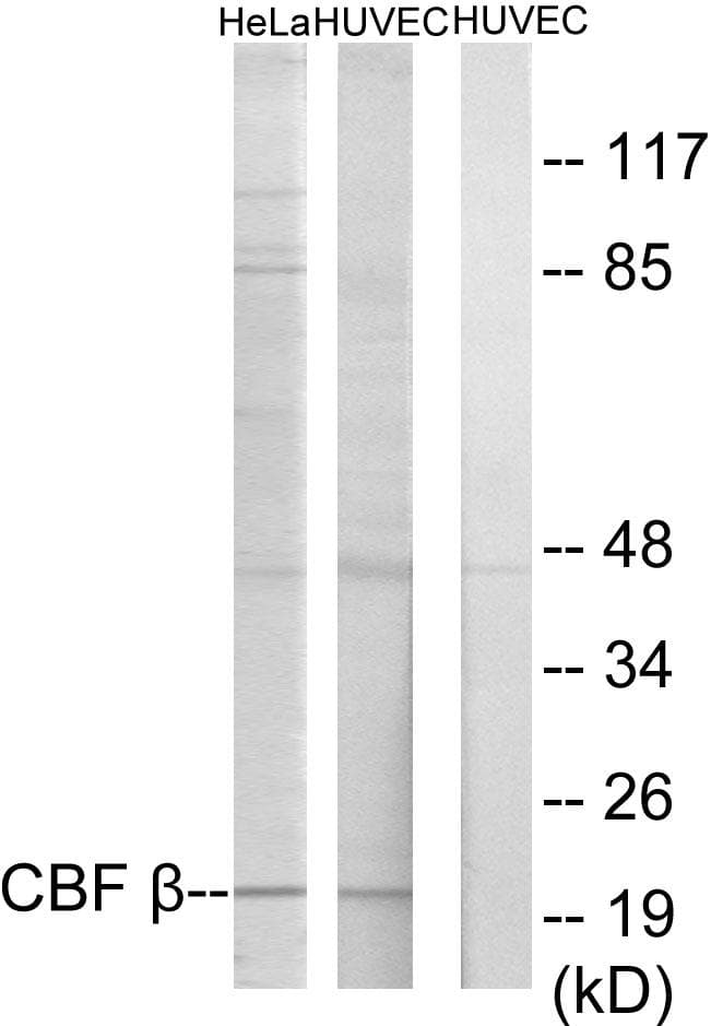 Polyclonal Rabbit anti-Human CBFB Antibody (IHC, WB)