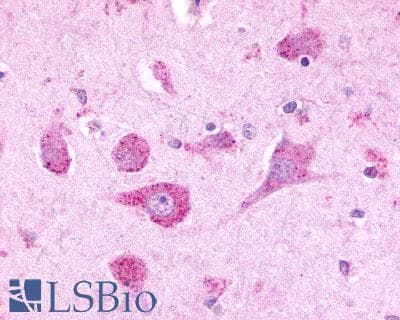 PathPlus™ ADGRL3 / LPHN3 Antibody (C-Terminus)