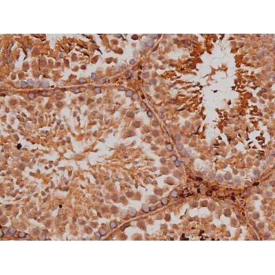 MAPT / Tau Antibody (phospho-Ser262)