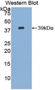 EZR / Ezrin Antibody (aa1-295, APC)