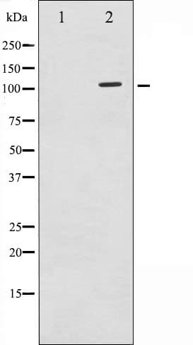 PLA2G4A Antibody (phospho-Ser505)
