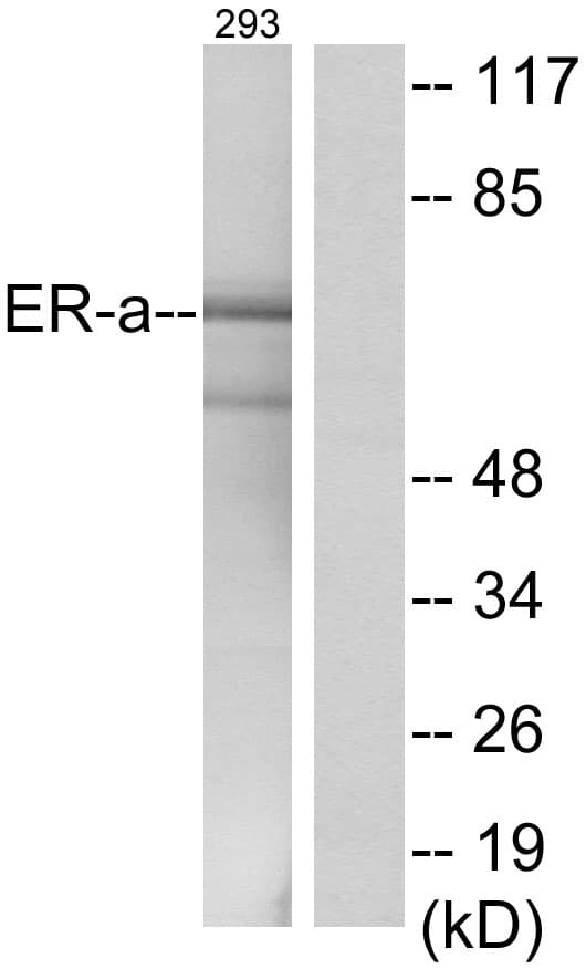 Polyclonal Rabbit anti-Human ER Alpha / Estrogen Receptor Antibody (aa501-550, IHC, IF, WB)