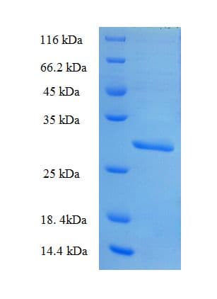 Human NXNL2 Protein (Recombinant His-SUMO)