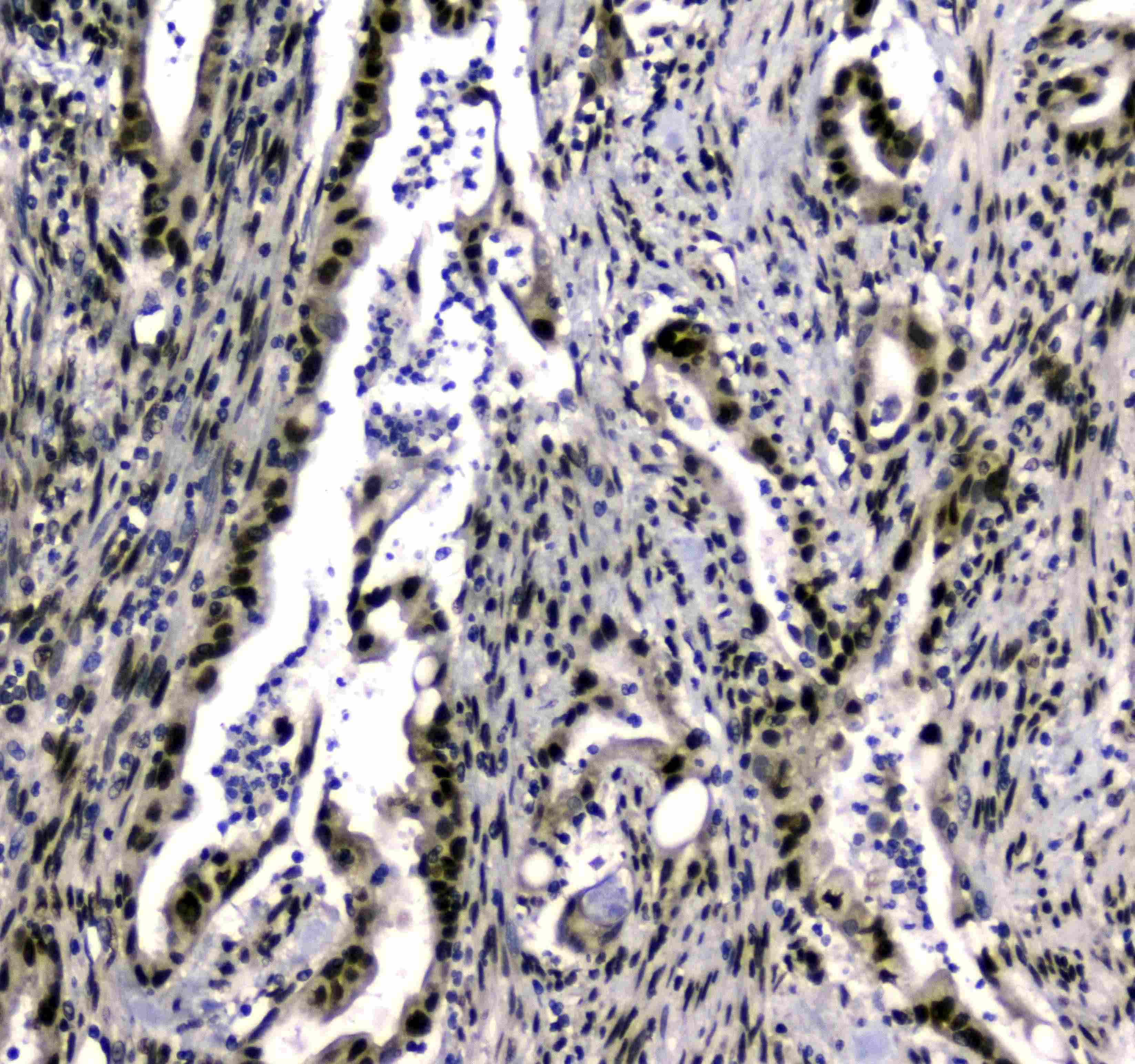 SAE2 / UBA2 Antibody