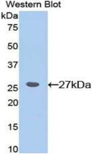 CD45 / LCA Antibody (aa371-556, PE)