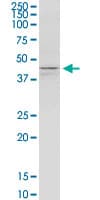 IHC-plus™ KCNJ5 / Kir3.4 / GIRK4 Antibody (clone 8D2)