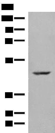 zinc finger and BTB domain containing 8 Antibody