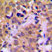 CHRNA1 Antibody (Internal)