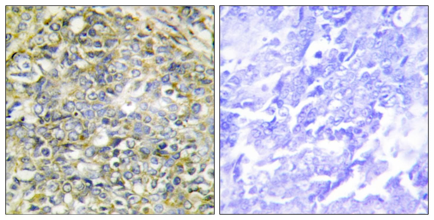 RB1 / Retinoblastoma / RB Antibody