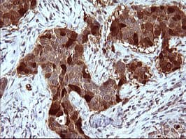 SERPINB3 Antibody (clone OTI1A12)