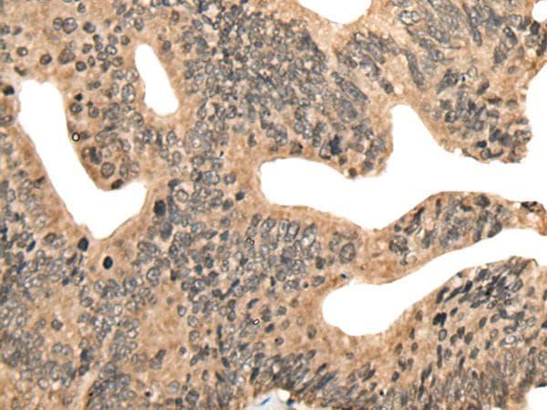 CCNB1IP1 Antibody