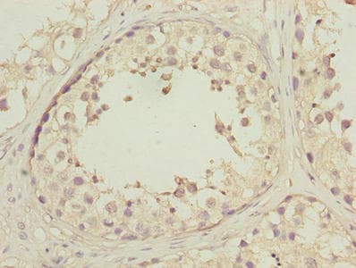 DNAJB1 / Hsp40 Antibody