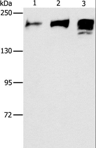 ACE / CD143 Antibody