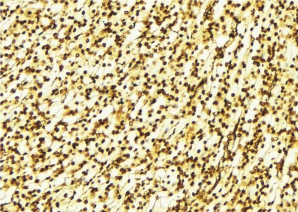 ATXN1 / SCA1 Antibody