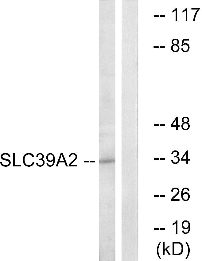 SLC39A2 / ZIP2 Antibody (aa11-60)