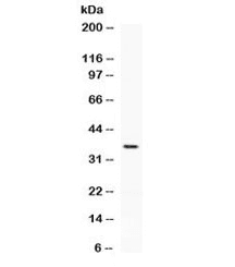 Polyclonal Rabbit anti-Human PD-L2 / PDCD1LG2 / CD273 Antibody (WB)