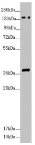 Polyclonal Rabbit anti-Human SFI1 Antibody (IHC, WB)