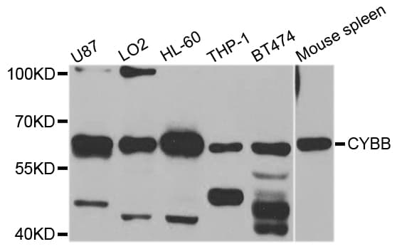 CYBB / NOX2 / gp91phox Antibody