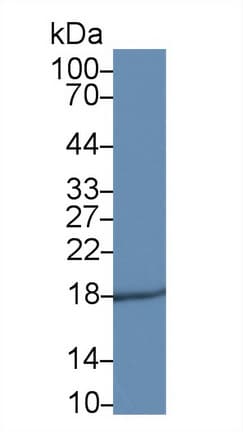 BTC / Betacellulin Antibody (aa32-118, FITC)