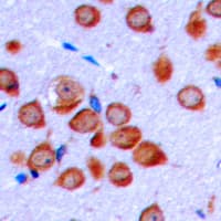 OLFML2B Antibody (Internal)