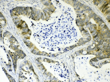 Polyclonal Rabbit anti-Human AKR1B10 Antibody (IHC, WB)