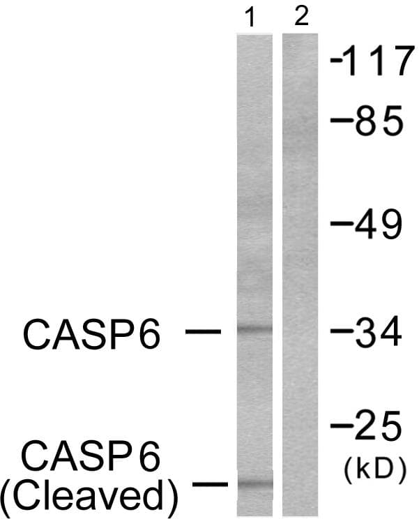 CASP6 / Caspase 6 Antibody (Cleaved-Asp179)