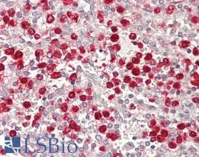 IHC-plus™ PRTN3 / Myeloblastin Antibody (aa28-248, clone 5B8)