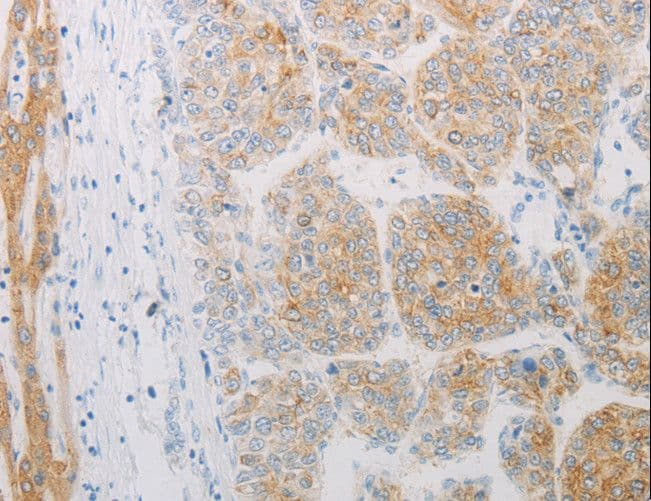 Polyclonal Rabbit anti-Human ADRB2 Antibody (IHC, WB)