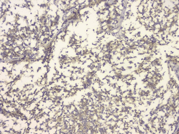 APP / Beta Amyloid Precursor Antibody