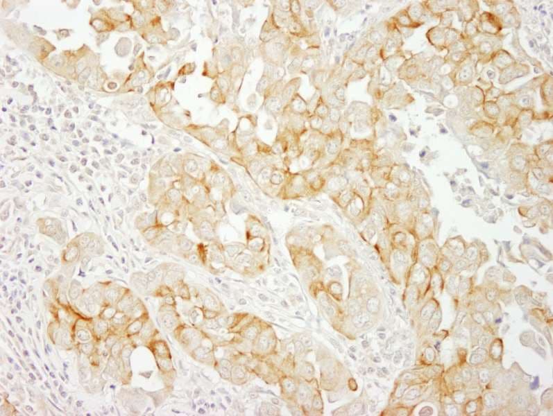 NOTCH2 Antibody (aa2421-2471)