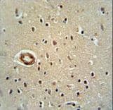 CWC22 Antibody (aa16-45)