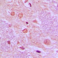 SS18 Antibody (N-Terminus)